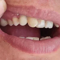 دندانسازی بانو دنت.با چک|خدمات آرایشگری و زیبایی|تربت‌حیدریه, داروپخش|دیوار