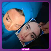 جشنواره تخفیفات جراحی لیفت صورت و جوانسازی