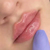 اف تزریق ژل روسی،عربی،خلیجی، بوتاکس|خدمات آرایشگری و زیبایی|شیراز, شهرک امیر کبیر|دیوار