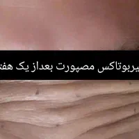 تزریق تخصصی ژل و بوتاکس رشت|خدمات آرایشگری و زیبایی|رشت, بلوار گیلان|دیوار