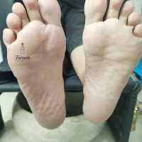 تخفیف ویژه کفسابی درمان ترک پا 270|خدمات آرایشگری و زیبایی|سبزوار, فیاض|دیوار