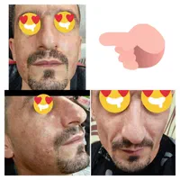 ژل وبوتاکس.چربی سوز.انزیم.فشیال.پیرسینگ|خدمات آرایشگری و زیبایی|اصفهان, احمدآباد|دیوار