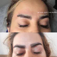 پاک کردن تتو و خالکوبی با لیزر کیوسوییچ پیکوشور|خدمات آرایشگری و زیبایی|مشهد, فرودگاه|دیوار