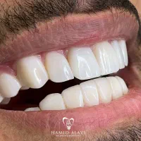 کلینیک دندانپزشکی دکتر حمید علوی