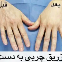 تخفیفات زیبایی