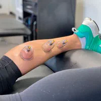 حجامت، بادکش، فصد خون، زالو درمانی، طب سوزنی