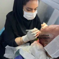 کاشت مو/PRP/ مزوتراپی/کاشت ریش