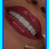 کامپوزیت دندان/ترمیم/دندانپزشکی/بیلچینگ|خدمات آرایشگری و زیبایی|تهران, تهرانپارس غربی|دیوار