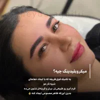 جذب مدل میکروبلیدینگ فوری