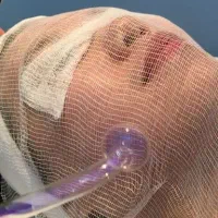 تخفیف فشیال تخصصی 470تومان