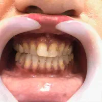 دندانپزشک قسطی بدون پیش پرداخت کلیه خدمات|خدمات آرایشگری و زیبایی|اصفهان, دشتستان|دیوار