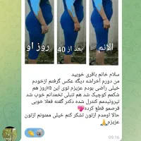 چربی سوزی ولاغری وزیبایی صورت|آرایشی، بهداشتی، درمانی|ایلام, |دیوار