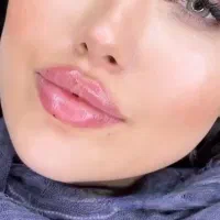 ژل بوتاکس چال لپ فیلربیکینی مزوتراپی پیرسینگ|خدمات آرایشگری و زیبایی|اسلام‌شهر, زرافشان|دیوار