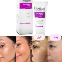 کرم جوانسازضدچین و چوروک