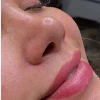 شیدینگ لب و دکاپاژ تیرگی لب