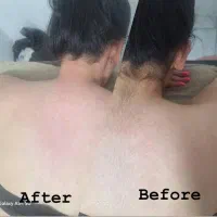 اپلاسیون بدن