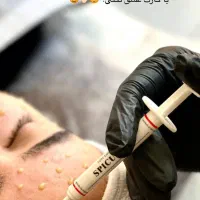 مدل جهت پاکسازی و فیشال و اسکراب اسکالپ پوست و مو|خدمات آرایشگری و زیبایی|مشهد, بهشت|دیوار
