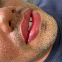 رفع تیرگی لب / ابرو و خط چشم دائم