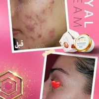 ژل کرم رویال|آرایشی، بهداشتی، درمانی|نورآباد ممسنی, |دیوار