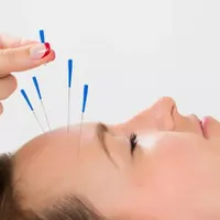 دوره تخصصی طب سوزنی با ارائه مدرک بین‌المللی|خدمات آموزشی|تهران, پیروزی|دیوار