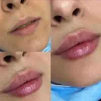 ژل لب|خدمات آرایشگری و زیبایی|شهرضا, |دیوار