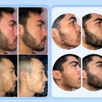 ریش و سیبلتو دوبرابر کن