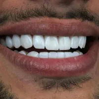 دندانپزشکی/لمینیت/کامپوزیت/جراحی دندان/ایمپلنت|خدمات آرایشگری و زیبایی|تهران, میدان ولیعصر|دیوار
