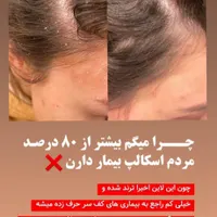 آموزش و خدمات اسکالپ اسکراب|خدمات آرایشگری و زیبایی|شیراز, سینما سعدی|دیوار