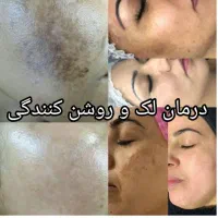 انجام خدمات پوستی هم بانوان و اقایان|خدمات آرایشگری و زیبایی|گرگان, |دیوار