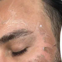 پاکسازی پوست با بروزترین دستگاه ها(آقا وخانم)