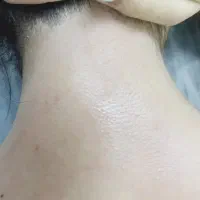 اپلاسیون فقط بانوان۵۸۰