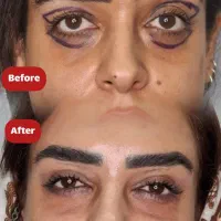جراحی / زیبایی