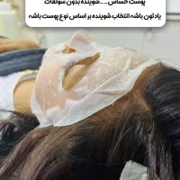 خدمات ژل و بوتاکس ولیزر و فیشیال و...|خدمات آرایشگری و زیبایی|اهواز, پادادشهر|دیوار