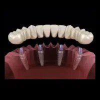 جذب نیروی پذیرش باسابقه در دندانپزشکی