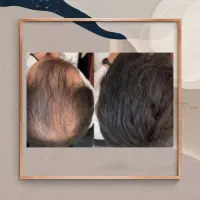 ریشه موهات تقویت میشه