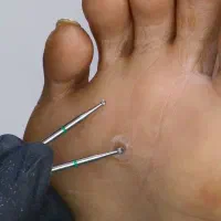 کفسابی پا.درمان ناخن پا.میخچه. ارتونیل ناخن پا|خدمات آرایشگری و زیبایی|کرج, کوی امامیه|دیوار