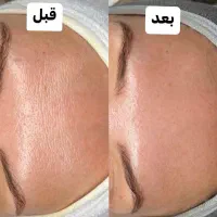 پوست سالم میخوای من کمکت میکنم فیشال بانوان|خدمات آرایشگری و زیبایی|شیراز, بعثت|دیوار