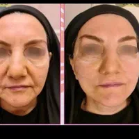 تخصصی هایفوهایفو تراپی پزشک(۱۲بعدی ۲۴بعدی ۳۶بعدی)|خدمات آرایشگری و زیبایی|مشهد, سناباد|دیوار