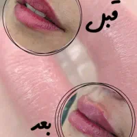 قیمت فیلر فقط 800