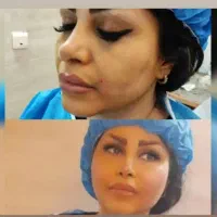 لابیاپلاستی/واژینوپلاستی/بوکال فت/ساکشن غبغب/کاشت|خدمات آرایشگری و زیبایی|تهران, فرمانیه|دیوار