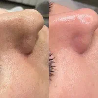 خدمات تخصصی پوست و فیشیال