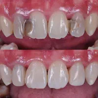 تکمیل البوم زیبایی کلیک‌کن