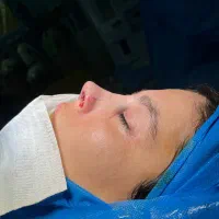 جراحی بینی باتخفیف ویژه جشنواره|خدمات آرایشگری و زیبایی|ساری, |دیوار