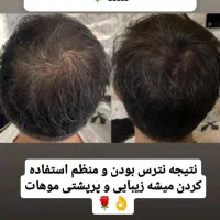 کرم ضد لک و کک و مک|آرایشی، بهداشتی، درمانی|گیلان غرب, |دیوار