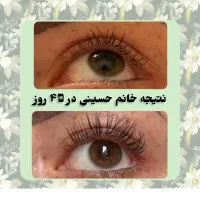 مژه ها و ابروهات رو تقویت کن|خدمات آرایشگری و زیبایی|کرمانشاه, |دیوار
