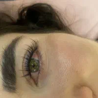 کاشت مژه هیدن