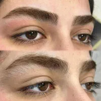 اصلاح صورت و ابرو(شرایط ویژه)