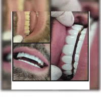 تاپ ترین برند کامپوزیت در تهران|خدمات آرایشگری و زیبایی|تهران, ایوانک|دیوار