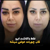 کلینیک/ جراحی بینی / ترمیم / تزریق ژل لب /|خدمات آرایشگری و زیبایی|تهران, سعادتآباد|دیوار