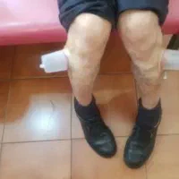 حجامت